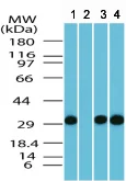 Western blot - Anti-FAM3C/ILEI antibody (AB72182)