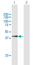 Western blot - Anti-FAM46C antibody (AB169699), expandable thumbnail