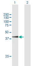 Western blot - Anti-FAM46C antibody (AB169699)