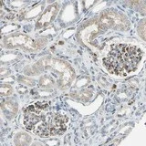 Immunohistochemistry (Formalin/PFA-fixed paraffin-embedded sections) - Anti-FAM49B antibody (AB121299)