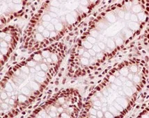 Immunohistochemistry (Formalin/PFA-fixed paraffin-embedded sections) - Anti-FAM50A/XAP5 antibody [EPR12816] (AB186410)