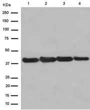 Western blot - Anti-FAM50A/XAP5 antibody [EPR12816] (AB186410)