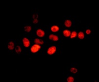 Immunocytochemistry/ Immunofluorescence - Anti-FAM50A/XAP5 antibody [EPR12817] (AB178683)