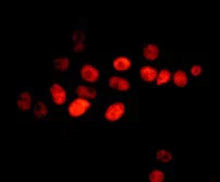 Immunocytochemistry/ Immunofluorescence - Anti-FAM50A/XAP5 antibody [EPR12817] (AB178683)