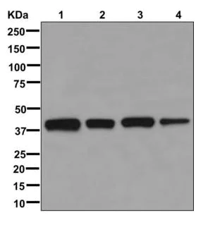 Western blot - Anti-FAM50A/XAP5 antibody [EPR12817] (AB178683)
