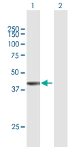 Western blot - Anti-FAM55A antibody (AB168285)