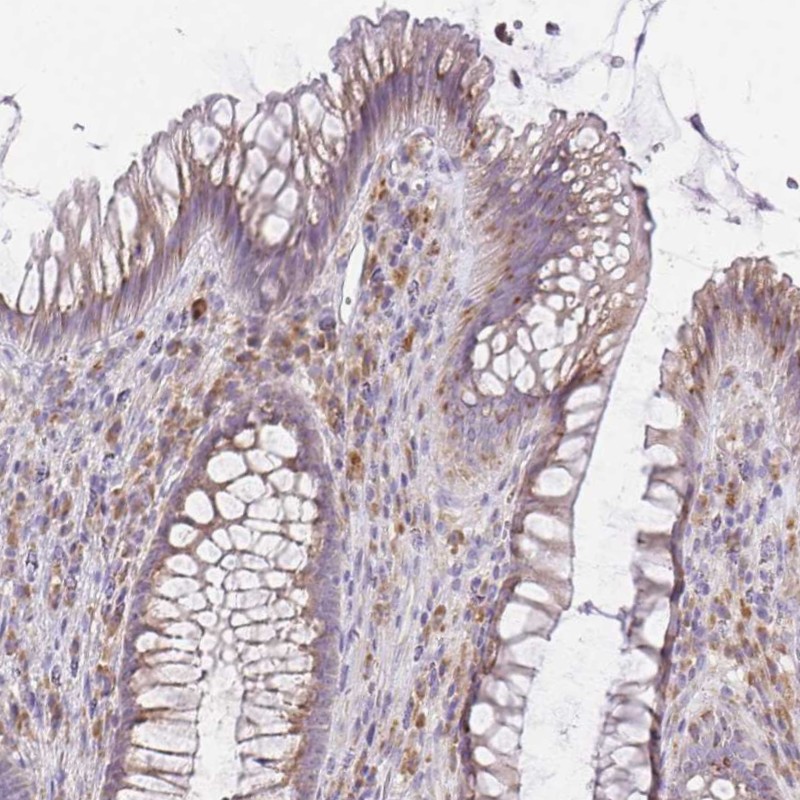 Immunohistochemistry (Formalin/PFA-fixed paraffin-embedded sections) - Anti-FAM5C antibody (AB254937)