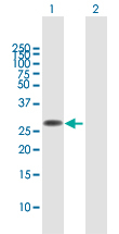 Western blot - Anti-FAM60A antibody (AB167180), expandable thumbnail