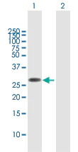 Western blot - Anti-FAM60A antibody (AB167180)