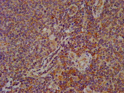 Immunohistochemistry (Formalin/PFA-fixed paraffin-embedded sections) - Anti-FAM62B antibody (AB239068)