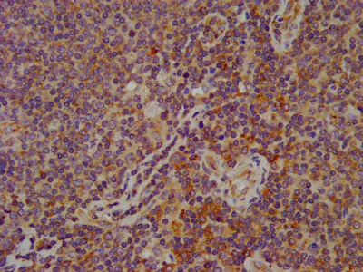 Immunohistochemistry (Formalin/PFA-fixed paraffin-embedded sections) - Anti-FAM62B antibody (AB239068)