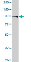 Western blot - Anti-FAM62B antibody (AB88900)