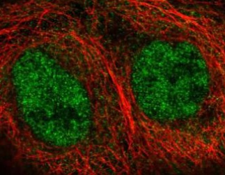 Immunocytochemistry/ Immunofluorescence - Anti-FAM63A antibody (AB220932)