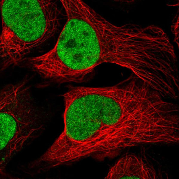 Immunocytochemistry/ Immunofluorescence - Anti-FAM63B antibody (AB151122), expandable thumbnail