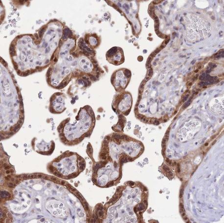 Immunohistochemistry (Formalin/PFA-fixed paraffin-embedded sections) - Anti-FAM63B antibody (AB151122), expandable thumbnail