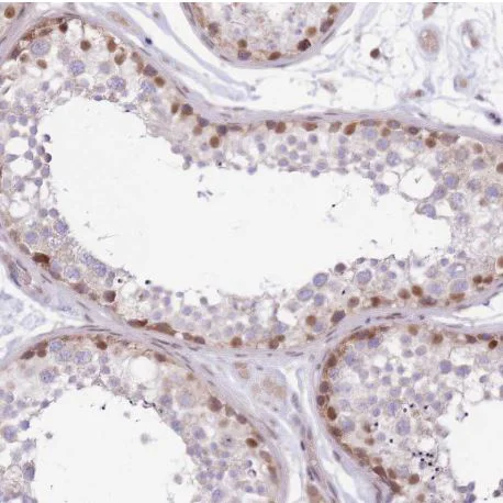 Immunohistochemistry (Formalin/PFA-fixed paraffin-embedded sections) - Anti-FAM63B antibody (AB151122)