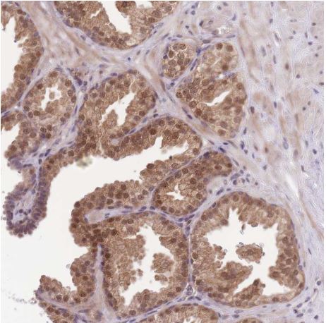 Immunohistochemistry (Formalin/PFA-fixed paraffin-embedded sections) - Anti-FAM63B antibody (AB151122), expandable thumbnail