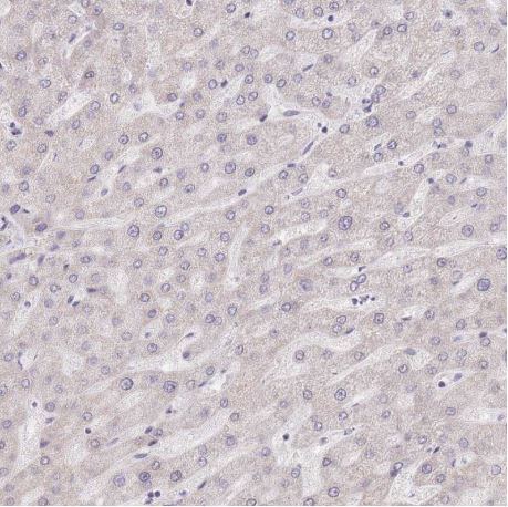 Immunohistochemistry (Formalin/PFA-fixed paraffin-embedded sections) - Anti-FAM63B antibody (AB151122), expandable thumbnail