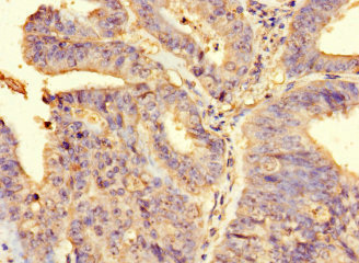 Immunohistochemistry (Formalin/PFA-fixed paraffin-embedded sections) - Anti-FAM65B antibody (AB234646)