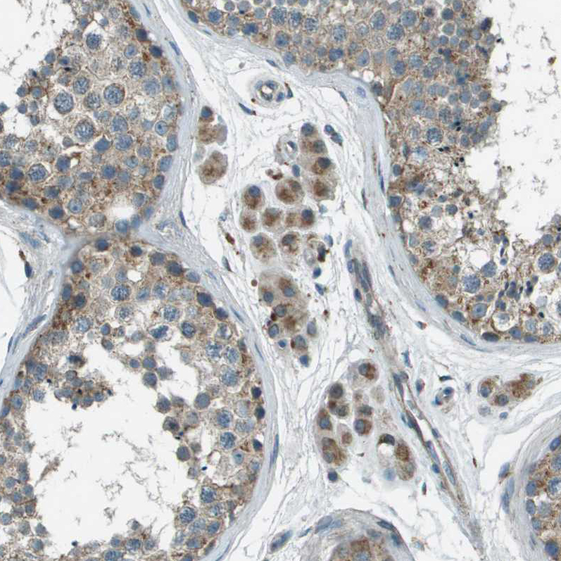 Immunohistochemistry (Formalin/PFA-fixed paraffin-embedded sections) - Anti-FAM73A antibody (AB121532)