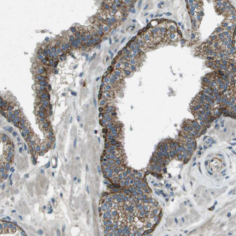 Immunohistochemistry (Formalin/PFA-fixed paraffin-embedded sections) - Anti-FAM73A antibody (AB121532)