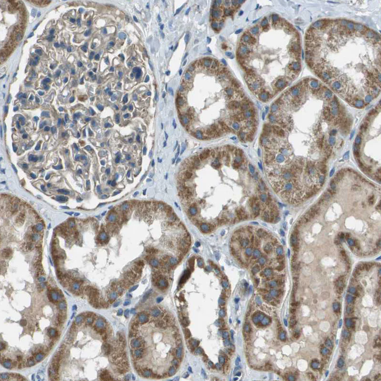 Immunohistochemistry (Formalin/PFA-fixed paraffin-embedded sections) - Anti-FAM73A antibody (AB121532)