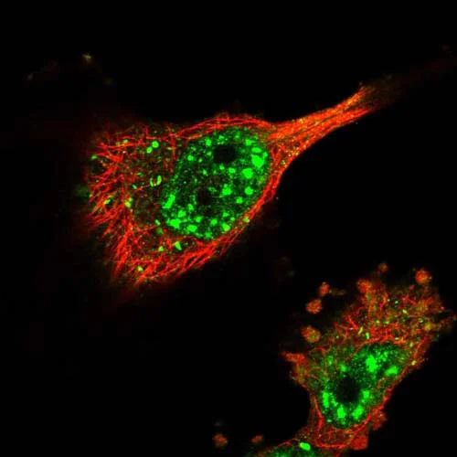 Immunocytochemistry/ Immunofluorescence - Anti-FAM83B antibody (AB122175)