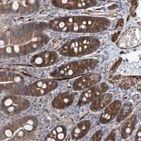 Immunohistochemistry (Formalin/PFA-fixed paraffin-embedded sections) - Anti-FAM83B antibody (AB122175)