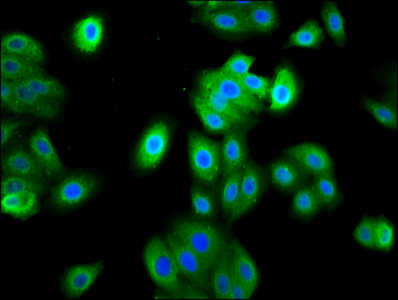 Immunocytochemistry/ Immunofluorescence - Anti-FAM83D antibody (AB236882)