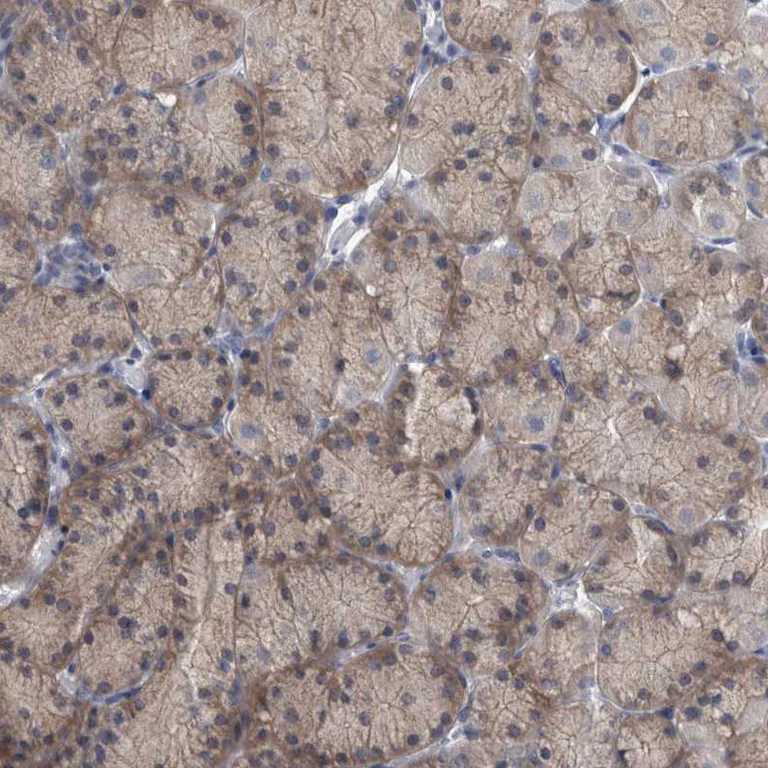 Immunohistochemistry (Formalin/PFA-fixed paraffin-embedded sections) - Anti-FAM83H antibody (AB121816)