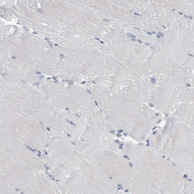 Immunohistochemistry (Formalin/PFA-fixed paraffin-embedded sections) - Anti-FAM83H antibody (AB121816)