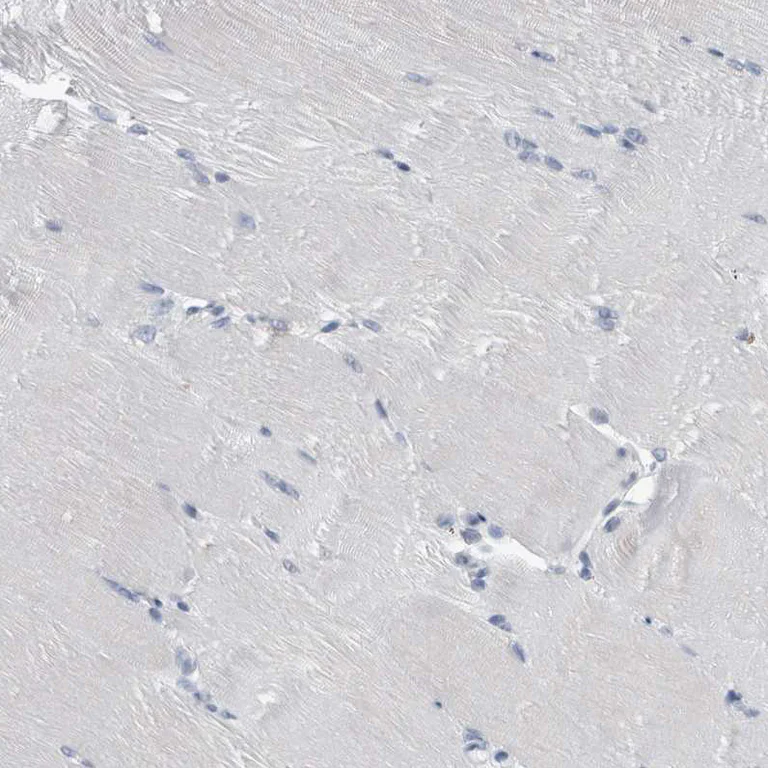 Immunohistochemistry (Formalin/PFA-fixed paraffin-embedded sections) - Anti-FAM83H antibody (AB121816)