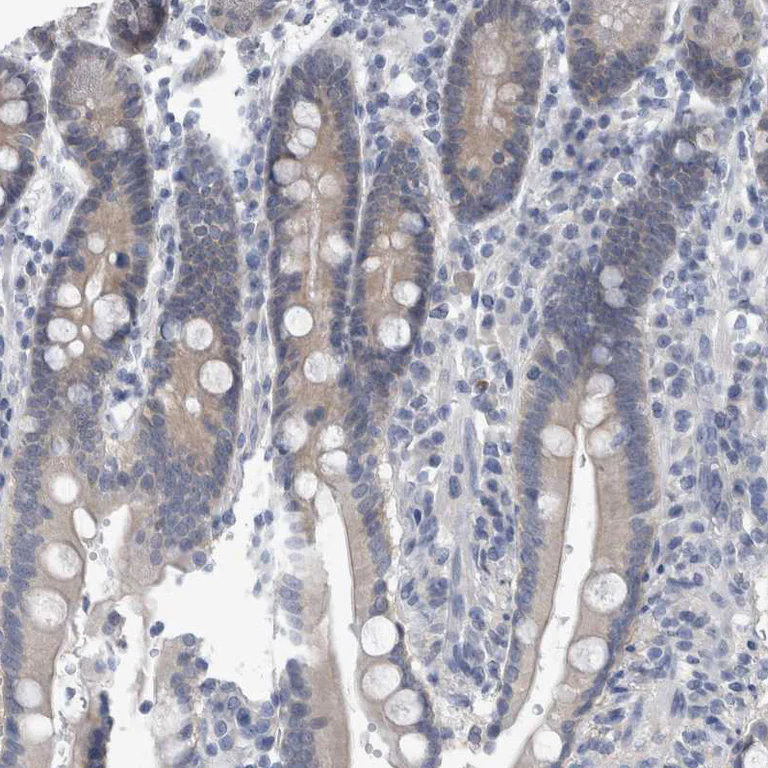 Immunohistochemistry (Formalin/PFA-fixed paraffin-embedded sections) - Anti-FAM83H antibody (AB121816)