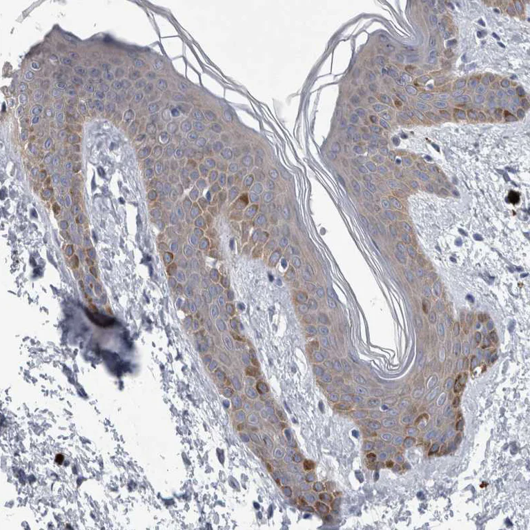 Immunohistochemistry (Formalin/PFA-fixed paraffin-embedded sections) - Anti-FAM83H antibody (AB121816)