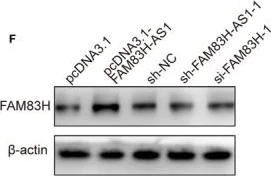 Western blot - Anti-FAM83H antibody (AB121816)