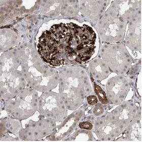 Immunohistochemistry (Formalin/PFA-fixed paraffin-embedded sections) - Anti-FAM83H antibody (AB121828)