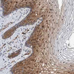 Immunohistochemistry (Formalin/PFA-fixed paraffin-embedded sections) - Anti-FAM83H antibody (AB121828)