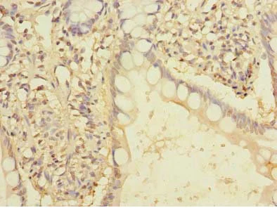 Immunohistochemistry (Formalin/PFA-fixed paraffin-embedded sections) - Anti-FAM86A antibody (AB235380)
