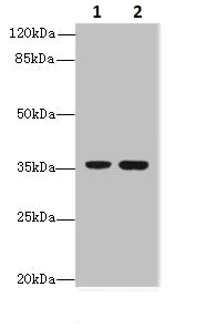 Western blot - Anti-FAM86A antibody (AB235380)