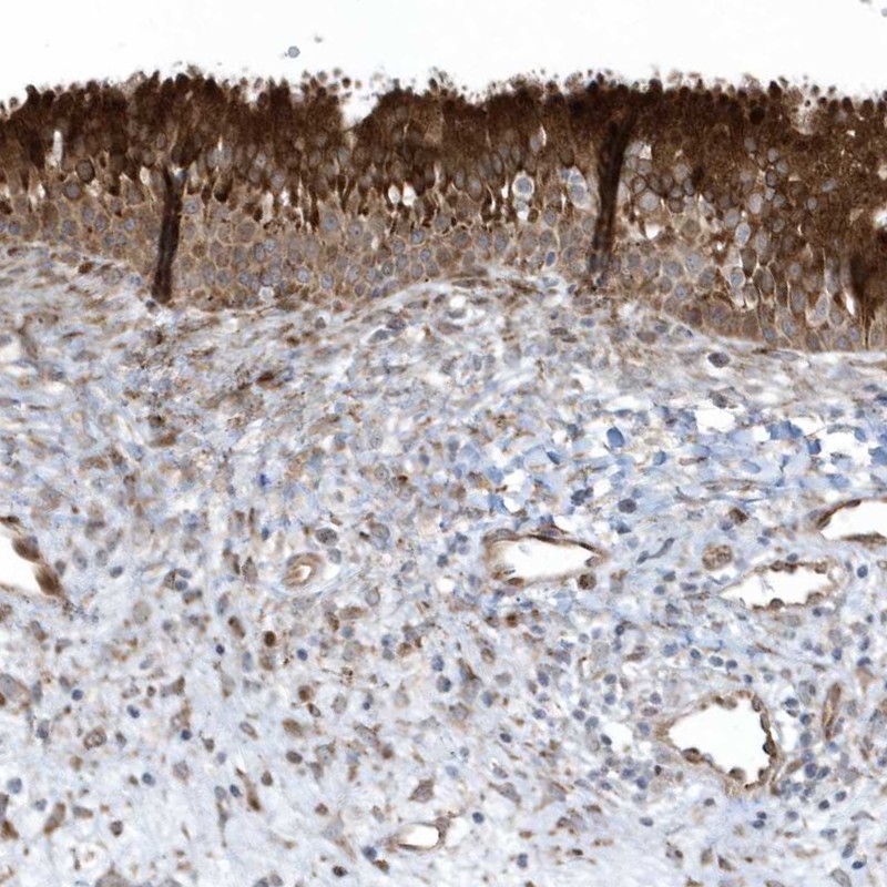 Immunohistochemistry (Formalin/PFA-fixed paraffin-embedded sections) - Anti-FAM98A antibody (AB204083)