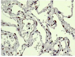 Immunohistochemistry (Formalin/PFA-fixed paraffin-embedded sections) - Anti-FAM98B antibody [EPR12872] - BSA and Azide free (AB250132)