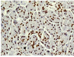 Immunohistochemistry (Formalin/PFA-fixed paraffin-embedded sections) - Anti-FAM98B antibody [EPR12872] - BSA and Azide free (AB250132)