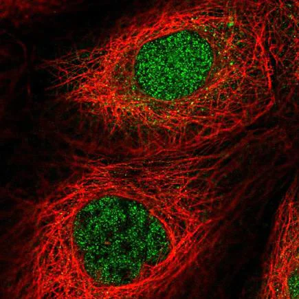 Immunocytochemistry/ Immunofluorescence - Anti-FAN1 antibody (AB222206)