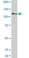 Western blot - Anti-FAN1 antibody (AB68572), expandable thumbnail