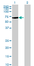 Western blot - Anti-FAN1 antibody (AB68572), expandable thumbnail