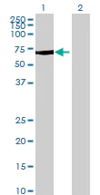 Western blot - Anti-FAN1 antibody (AB68572)