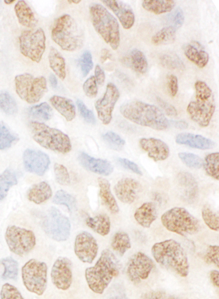 Immunohistochemistry (Formalin/PFA-fixed paraffin-embedded sections) - Anti-FAN1 antibody (AB95171)