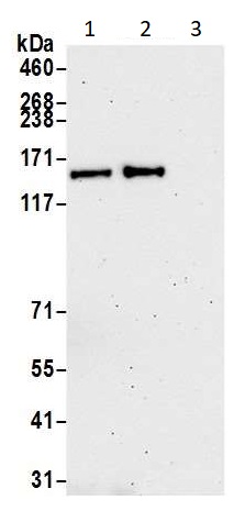 Immunoprecipitation - Anti-FANCA/FAA antibody (AB264257)