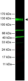 Western blot - Anti-FANCA/FAA antibody (AB5063)
