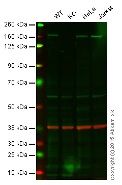 Western blot - Anti-FANCA/FAA antibody [EPR16519-42] - BSA and Azide free (AB251345)